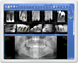 ViewRex Dental  Made in Korea